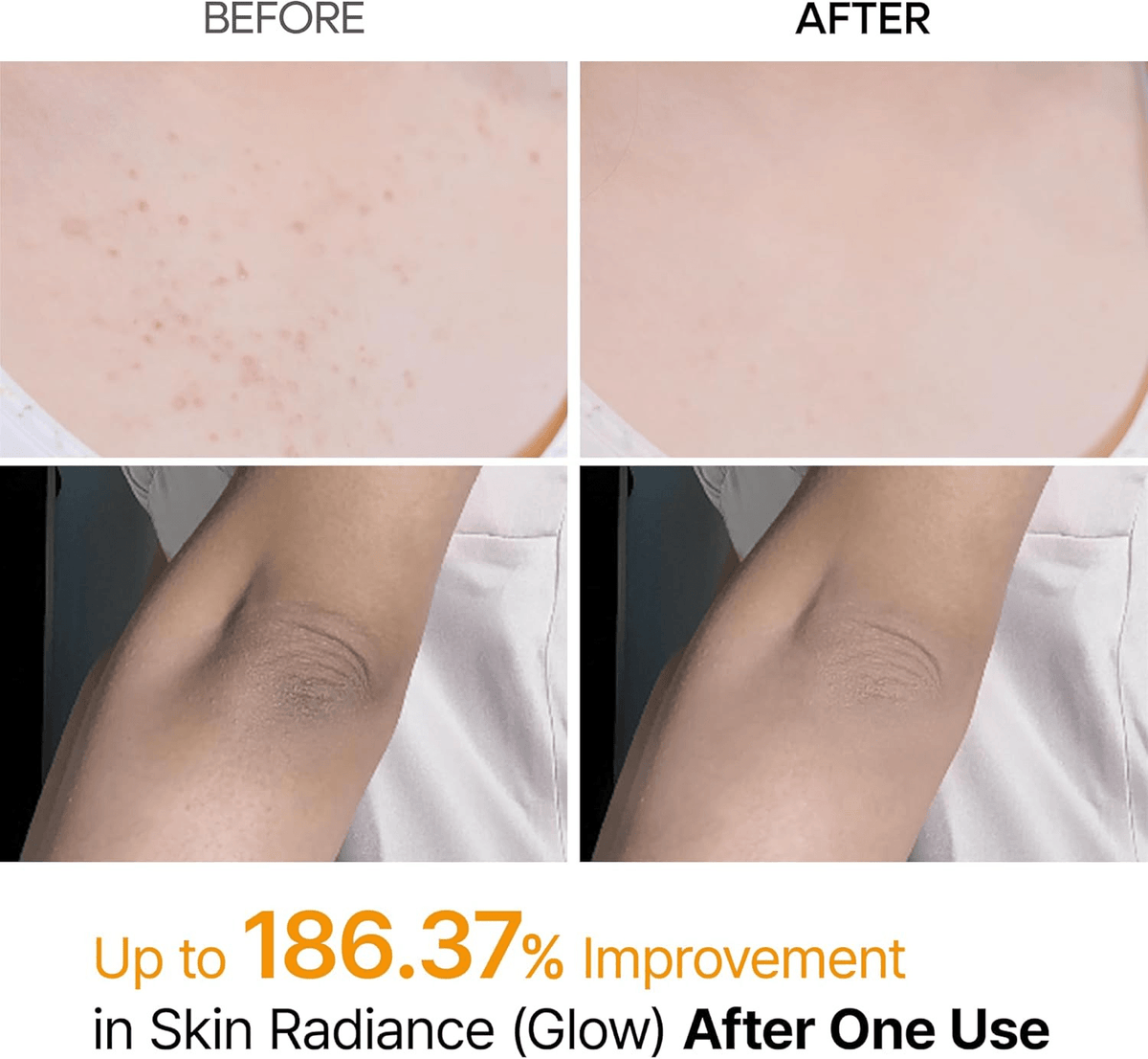 Dr.Melaxin Peel Shot Exfoliating Kojic Acid Turmeric Spray - 200ml