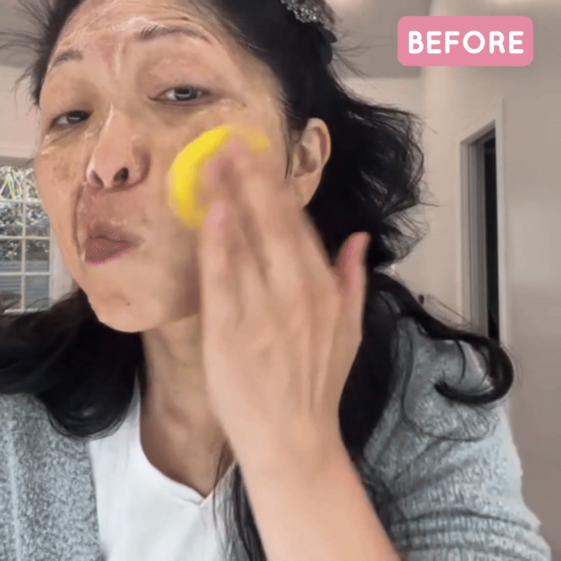 Kojic Acid & Turmeric Cleansing Pads – Buy 1 Get 1 Free