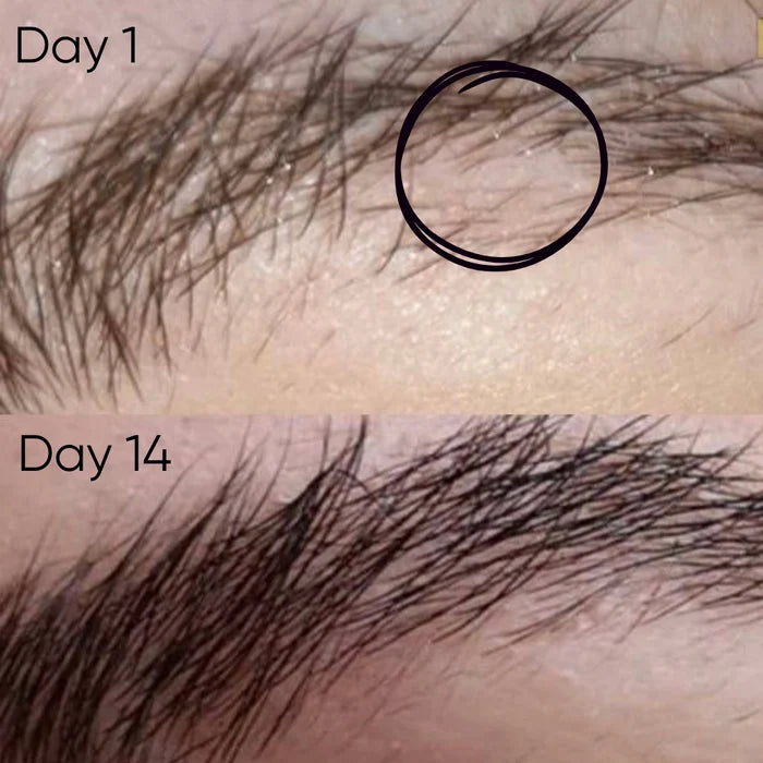 Eyebrow Growth Kit